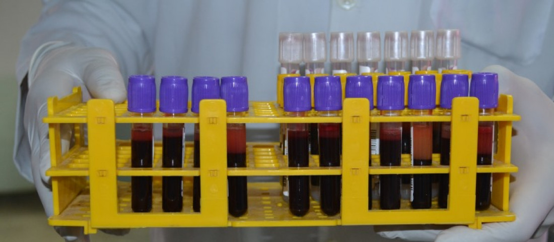 Amostras coletadas durante coleta de sangue seguem para testes laboratoriais | Fotos: Ascom/SES
