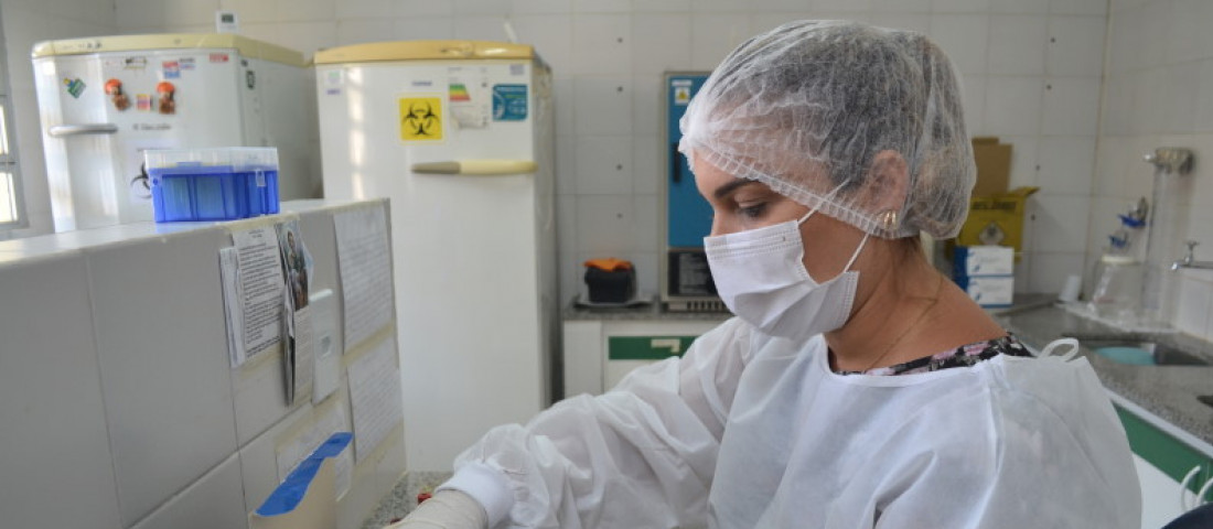 Lacen processa amostras para diagnóstico do Calazar e Raiva Animal. Foto: Ascom/SES