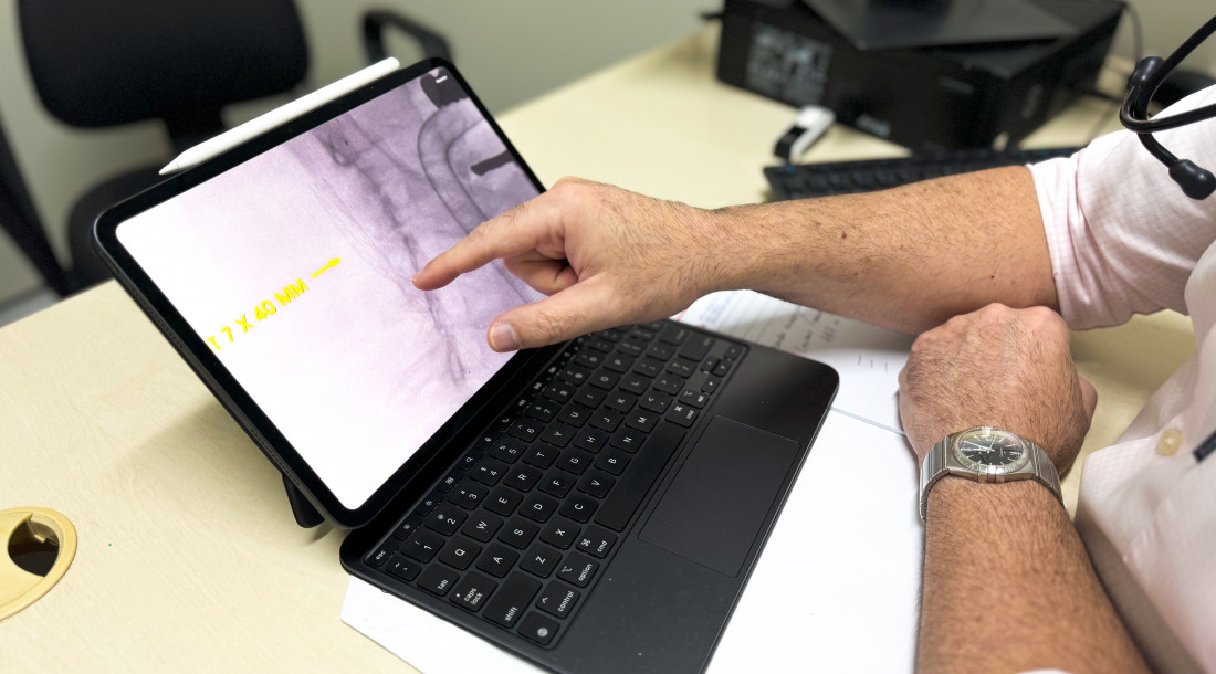 Atendimentos vão de varizes a aneurismas complexos, com equipe que conta com diversos especialistas / Foto: Ascom Ipesaúde
